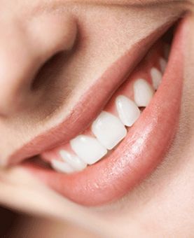 Clínica Dental Laura Rodríguez sonrisa 