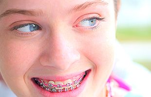 Clínica Dental Laura Rodríguez niña sonriendo